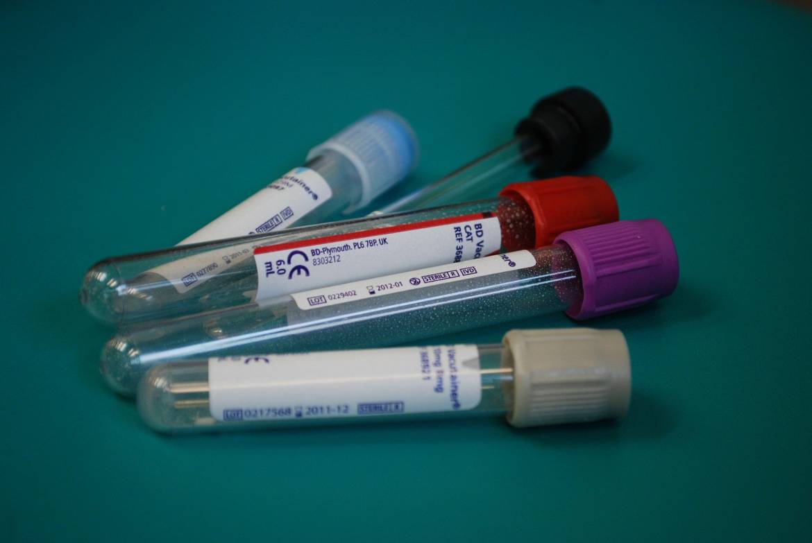 Monaco receives Rapid Antigen Tests